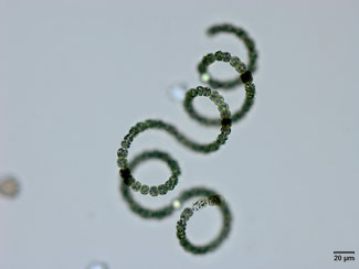 anabaena3smscale