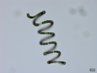 anabaenaspirilis05smscale