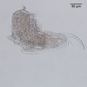 Daphnia longiremus postabdomen