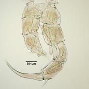 Aglaodiaptomus clavipes 5th leg