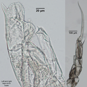 Male 5th leg Hesperodiaptomus shoshone