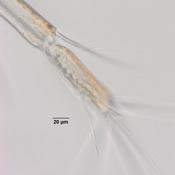 Macrocyclops fuscus hyaline membrane