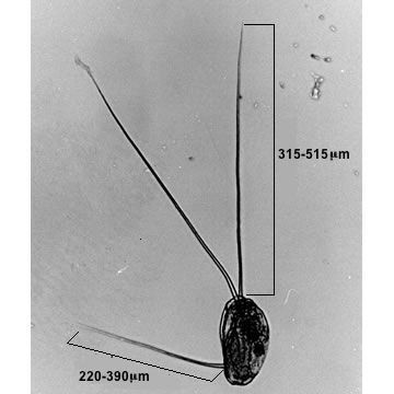 Filinia longiseta