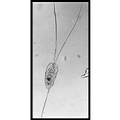Filinia longiseta