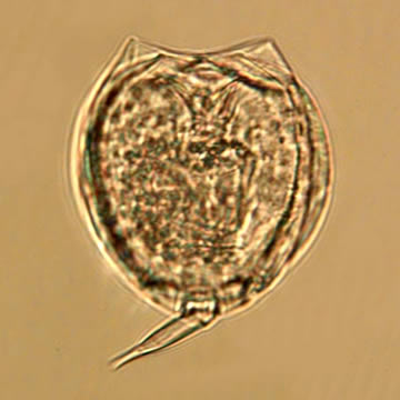 Monostyla closterocerca