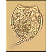 Monostyla closterocerca