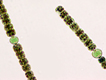 anabaena