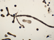 micro